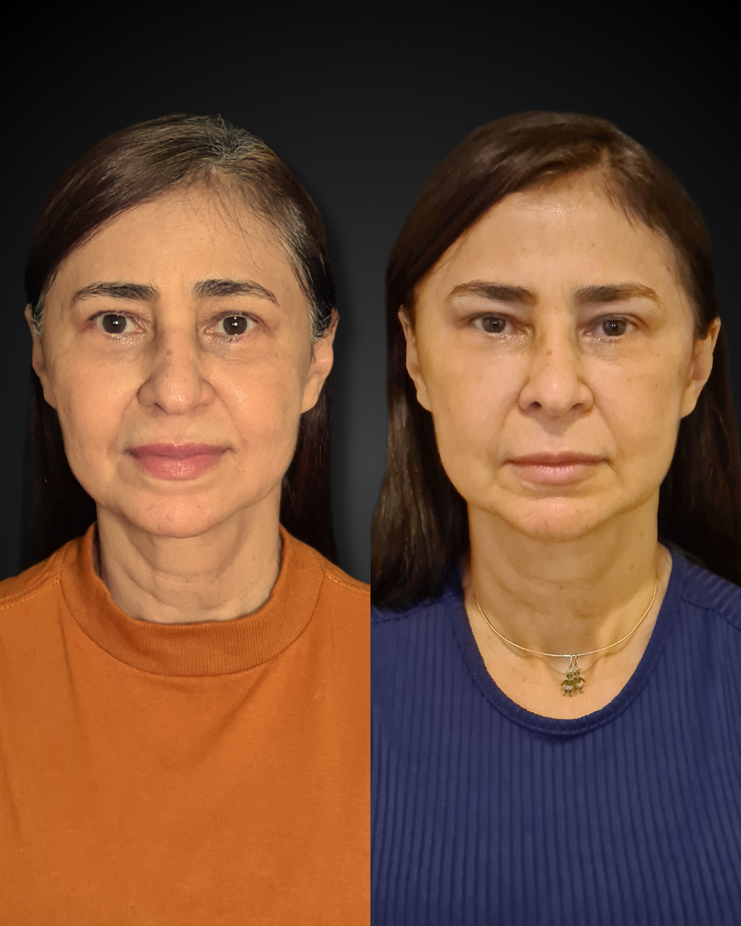 Cópia de Cópia de Cópia de Design sem nome (6)