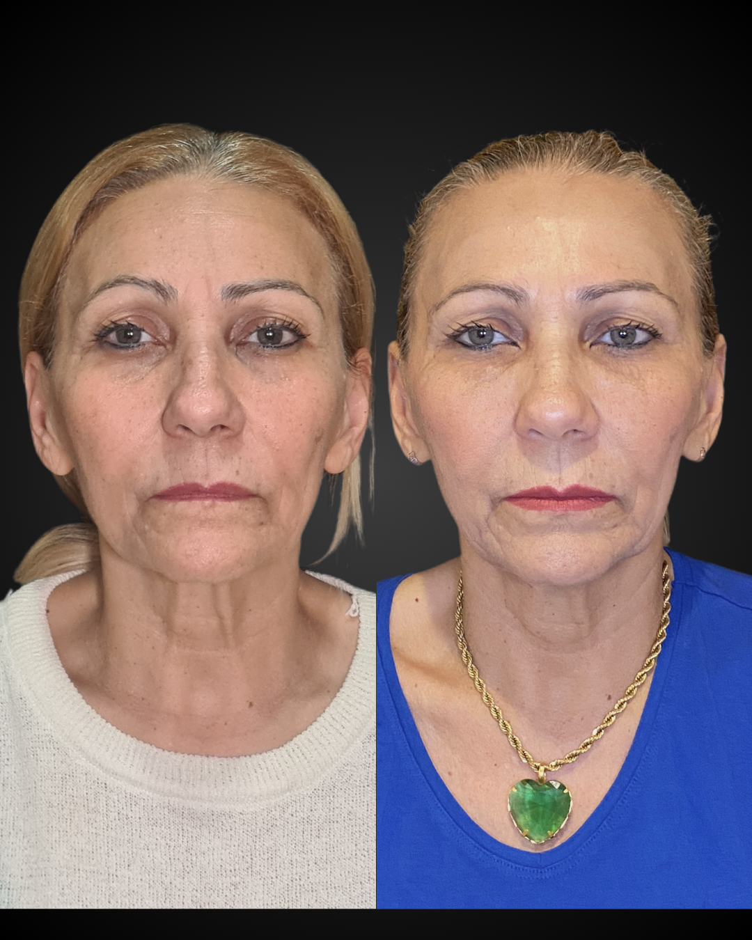 Cópia de Design sem nome